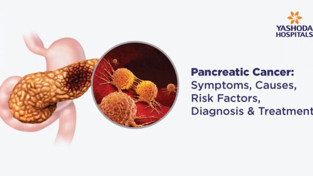 chu grenoble cancer pancreas — FR news